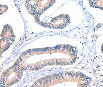 FHL5 Antibody in Immunohistochemistry (Paraffin) (IHC (P))