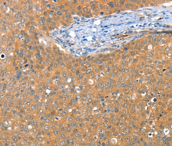 ACY3 Antibody in Immunohistochemistry (Paraffin) (IHC (P))