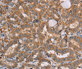Aladin Antibody in Immunohistochemistry (Paraffin) (IHC (P))