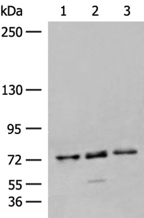 CCP3 Antibody in Western Blot (WB)