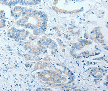 AKAP7 Antibody in Immunohistochemistry (Paraffin) (IHC (P))