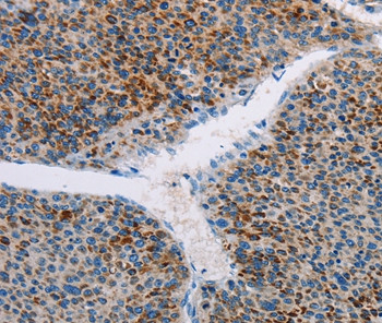 AMOTL2 Antibody in Immunohistochemistry (Paraffin) (IHC (P))