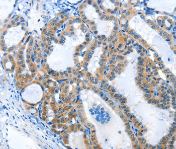 ANKMY1 Antibody in Immunohistochemistry (Paraffin) (IHC (P))