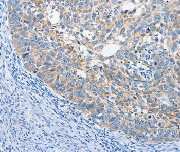 ANKMY2 Antibody in Immunohistochemistry (Paraffin) (IHC (P))