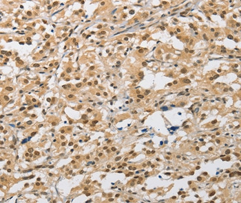 AMZ2 Antibody in Immunohistochemistry (Paraffin) (IHC (P))