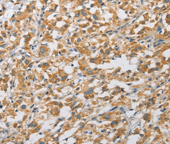 ARHGAP5 Antibody in Immunohistochemistry (Paraffin) (IHC (P))