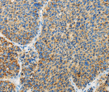ARHGEF3 Antibody in Immunohistochemistry (Paraffin) (IHC (P))