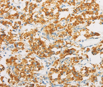 IDH3B Antibody in Immunohistochemistry (Paraffin) (IHC (P))