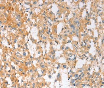 EPS15R Antibody in Immunohistochemistry (Paraffin) (IHC (P))