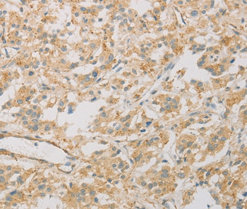 KLF17 Antibody in Immunohistochemistry (Paraffin) (IHC (P))