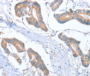 MTMR7 Antibody in Immunohistochemistry (Paraffin) (IHC (P))