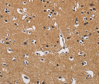 CBY1 Antibody in Immunohistochemistry (Paraffin) (IHC (P))