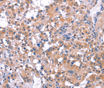 ELP2 Antibody in Immunohistochemistry (Paraffin) (IHC (P))