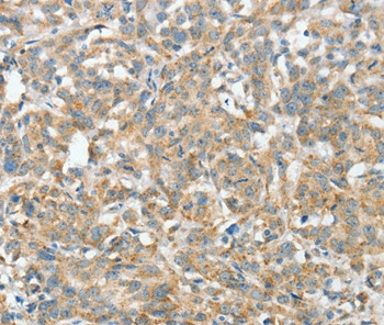 ASCC1 Antibody in Immunohistochemistry (Paraffin) (IHC (P))