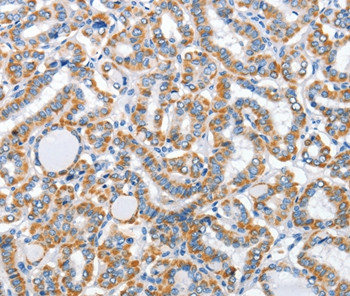 ARL11 Antibody in Immunohistochemistry (Paraffin) (IHC (P))