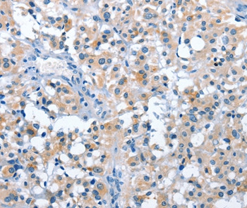 ASB2 Antibody in Immunohistochemistry (Paraffin) (IHC (P))