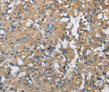 CAB39L Antibody in Immunohistochemistry (Paraffin) (IHC (P))