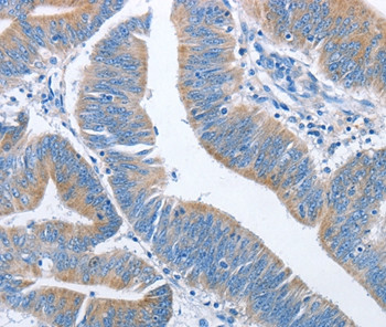NCAPD2 Antibody in Immunohistochemistry (Paraffin) (IHC (P))