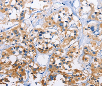 CAPZA3 Antibody in Immunohistochemistry (Paraffin) (IHC (P))