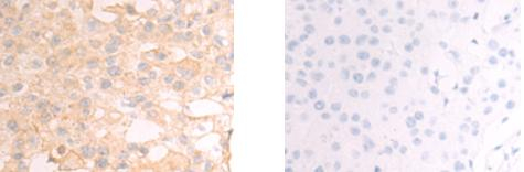 CHDH Antibody in Immunohistochemistry (Paraffin) (IHC (P))