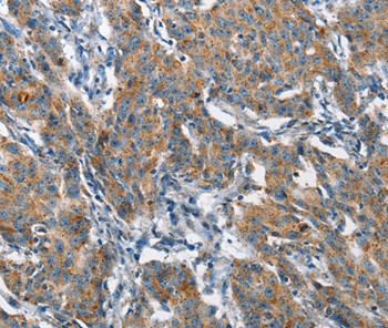 CHMP1A Antibody in Immunohistochemistry (Paraffin) (IHC (P))