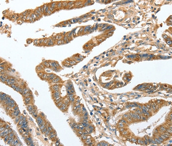 CKAP2 Antibody in Immunohistochemistry (Paraffin) (IHC (P))