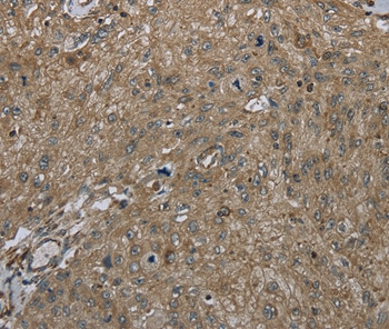CLPS Antibody in Immunohistochemistry (Paraffin) (IHC (P))