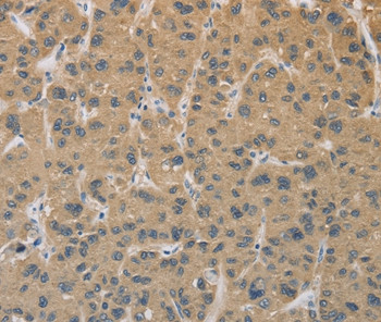 CYFIP2 Antibody in Immunohistochemistry (Paraffin) (IHC (P))