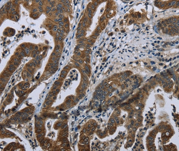 BRINP1 Antibody in Immunohistochemistry (Paraffin) (IHC (P))