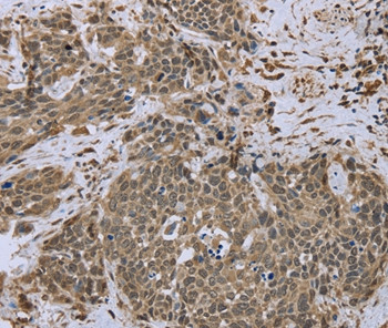 Dynactin 4 Antibody in Immunohistochemistry (Paraffin) (IHC (P))