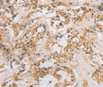 DCTN5 Antibody in Immunohistochemistry (Paraffin) (IHC (P))