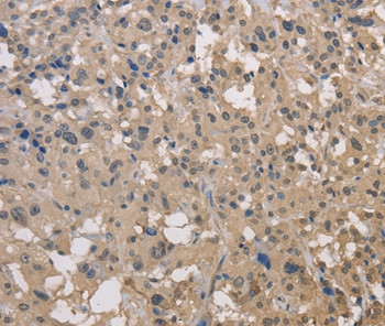 DRG1 Antibody in Immunohistochemistry (Paraffin) (IHC (P))