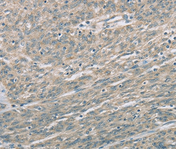 EDA2R Antibody in Immunohistochemistry (Paraffin) (IHC (P))