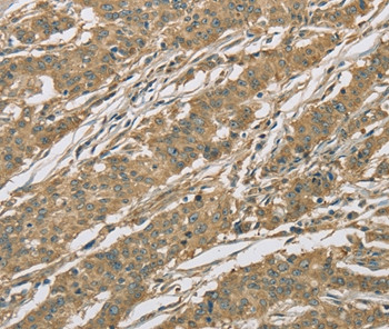 eIF3f Antibody in Immunohistochemistry (Paraffin) (IHC (P))