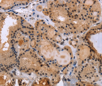 KIF25 Antibody in Immunohistochemistry (Paraffin) (IHC (P))