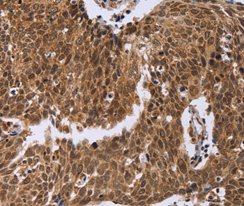 ERCC6L Antibody in Immunohistochemistry (Paraffin) (IHC (P))