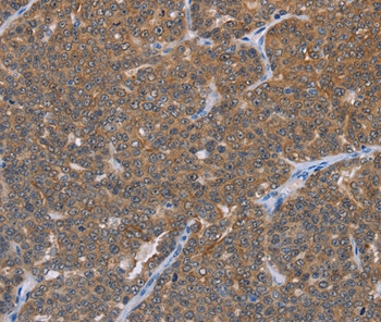 FABP6 Antibody in Immunohistochemistry (Paraffin) (IHC (P))