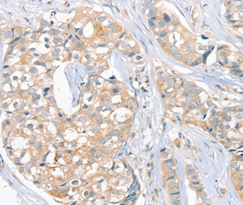 FAIM3 Antibody in Immunohistochemistry (Paraffin) (IHC (P))