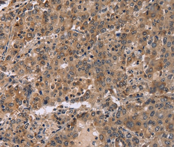 FAM107A Antibody in Immunohistochemistry (Paraffin) (IHC (P))