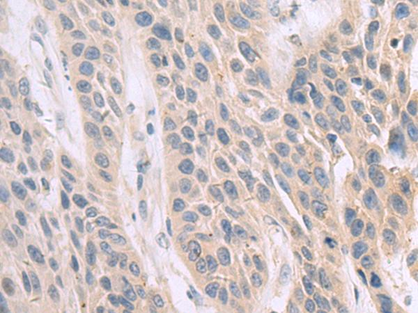 FAR2 Antibody in Immunohistochemistry (Paraffin) (IHC (P))