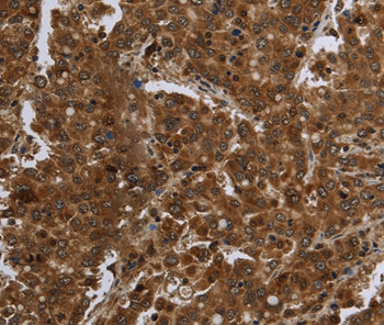 FASTKD1 Antibody in Immunohistochemistry (Paraffin) (IHC (P))