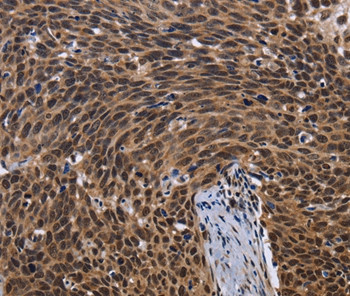 FASTKD5 Antibody in Immunohistochemistry (Paraffin) (IHC (P))