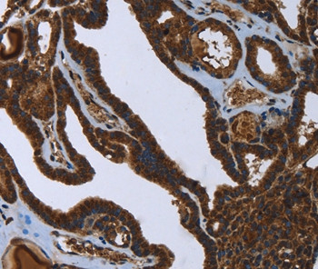 FASTKD2 Antibody in Immunohistochemistry (Paraffin) (IHC (P))