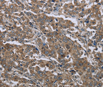 GGCX Antibody in Immunohistochemistry (Paraffin) (IHC (P))