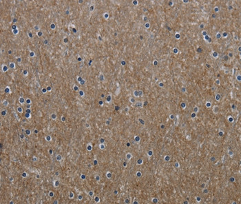 GNG2 Antibody in Immunohistochemistry (Paraffin) (IHC (P))