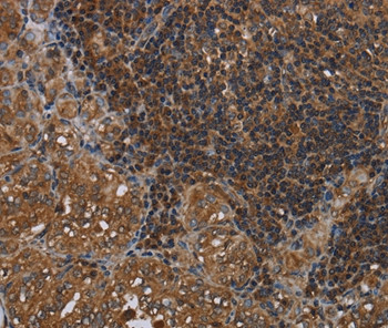 HOMER2 Antibody in Immunohistochemistry (Paraffin) (IHC (P))
