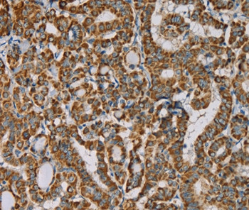 Importin 13 Antibody in Immunohistochemistry (Paraffin) (IHC (P))