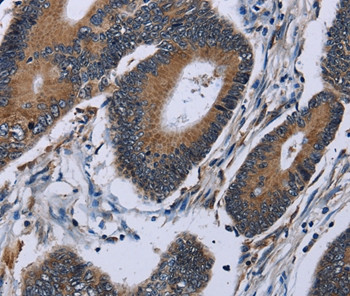 Importin 4 Antibody in Immunohistochemistry (Paraffin) (IHC (P))