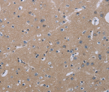 KLHL2 Antibody in Immunohistochemistry (Paraffin) (IHC (P))