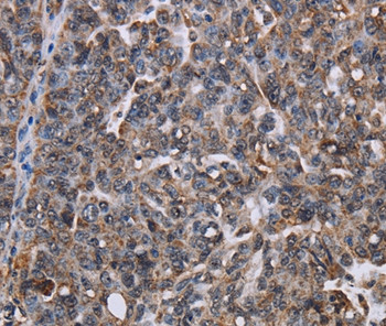 LDOC1 Antibody in Immunohistochemistry (Paraffin) (IHC (P))